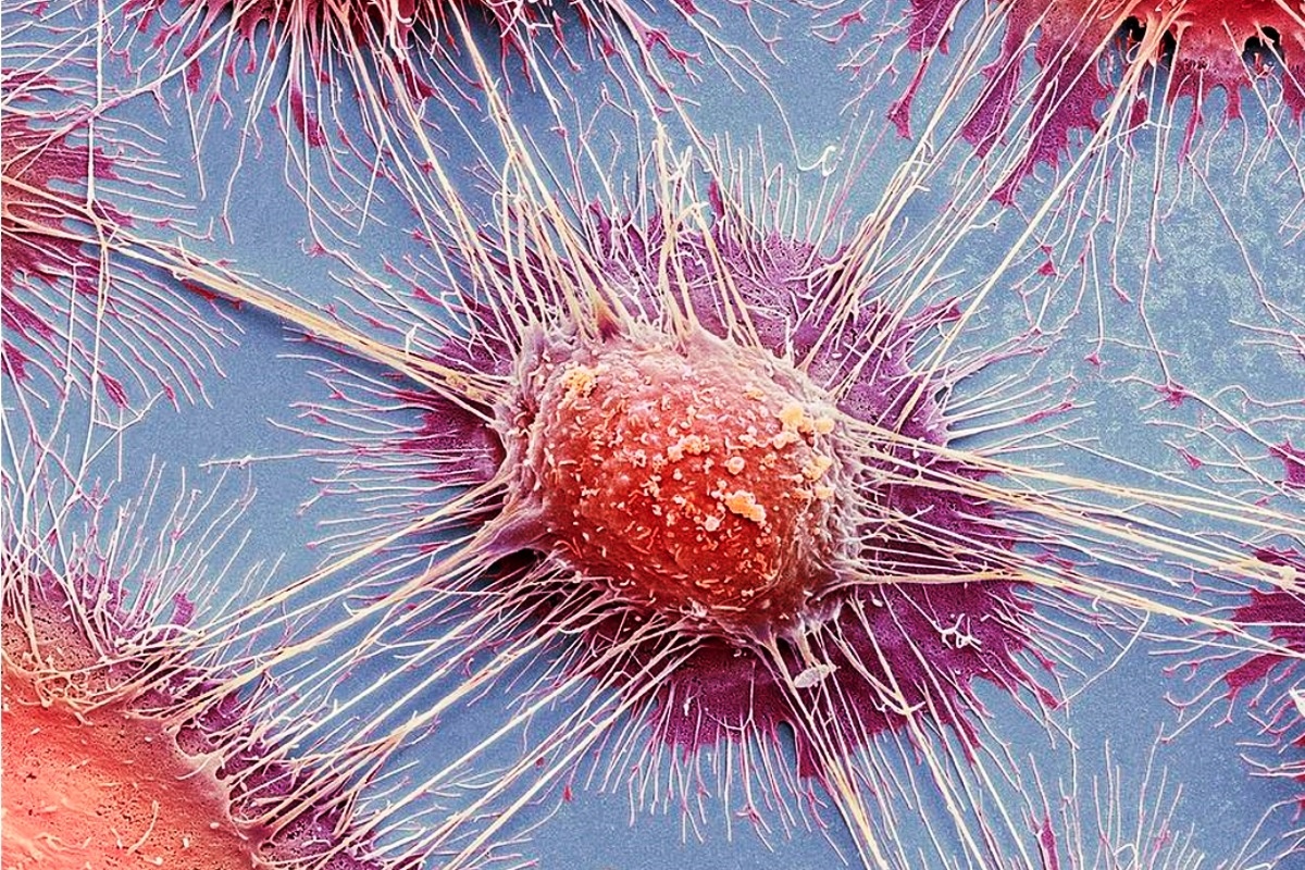 Грибок Candida и рак: связь, которую нельзя игнорировать