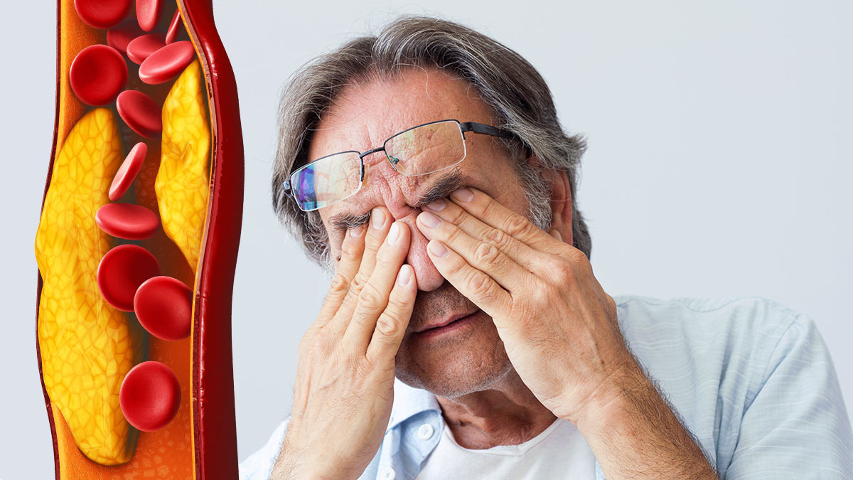 12 нестандартных причин высокого холестерина